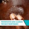 image:imageCeraVe Acne Treatment Face Wash Salicylic Acid Cleanser with Purifying Clay Niacinamide and Ceramides Pore Control and Blackhead Remover 8 Ounce16 Fl Oz Pack of 1